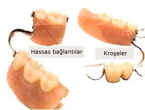 Hassa Tutuculu Protez